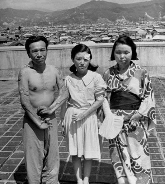 Photos d&apos;archives : Hiroshima après la bombe atomique
