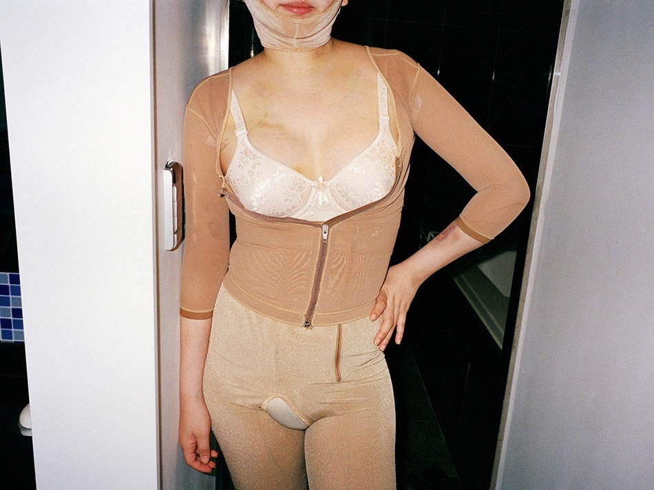 Les Coréennes et la chirurgie esthétique