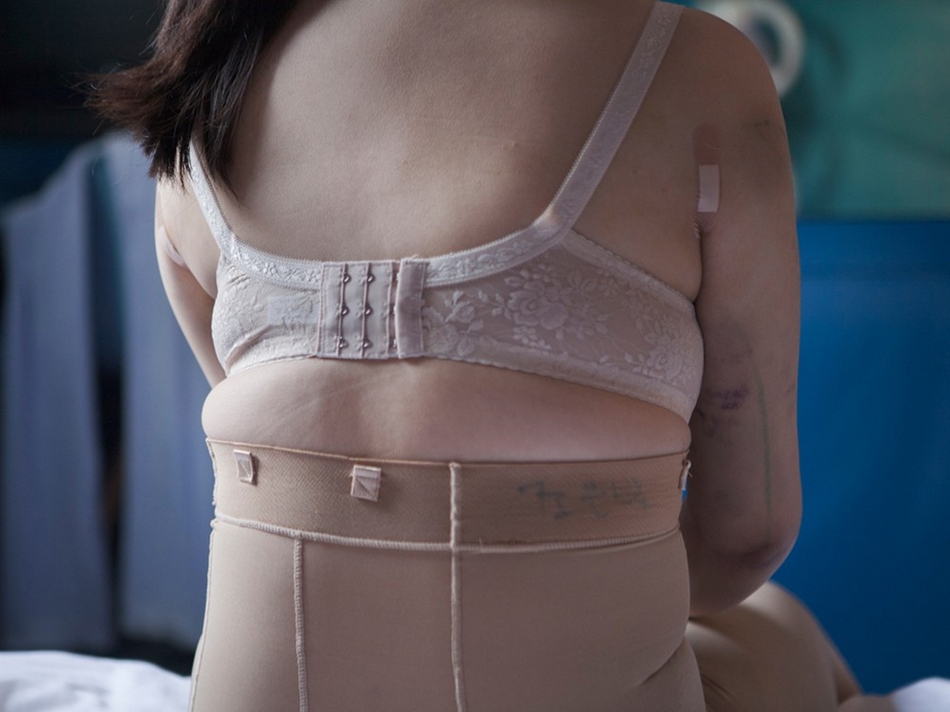 Les Coréennes et la chirurgie esthétique