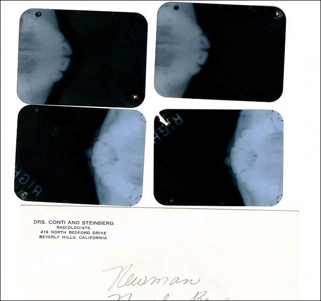 Marilyn Monroe s'était fait refaire le nez et le menton