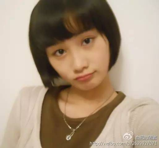 Une jeune femme défigurée par des brûlures affronte son horrible passé avec courage