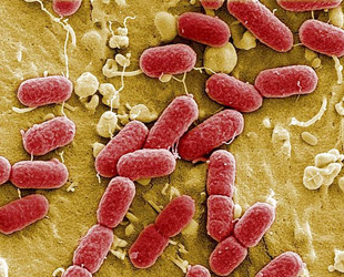 Das Helmholtz-Zentrums für Infektionsforschung (HZI) in Braunschweig hat nun einige Elektronenmikroskopaufnahmen von EHEC-Bakterien veröffentlicht. Die in Deutschland ausgebrochene EHEC-Epidemie hat bereits 14 Menschen getötet und mehr als 140 infiziert.