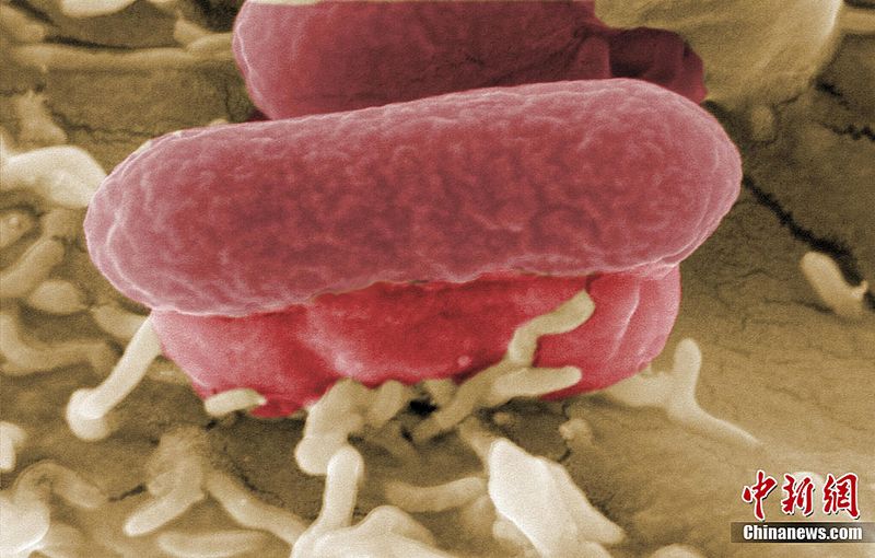 Das Helmholtz-Zentrums für Infektionsforschung (HZI) in Braunschweig hat nun einige Elektronenmikroskopaufnahmen von EHEC-Bakterien veröffentlicht. Die in Deutschland ausgebrochene EHEC-Epidemie hat bereits 14 Menschen getötet und mehr als 140 infiziert. 