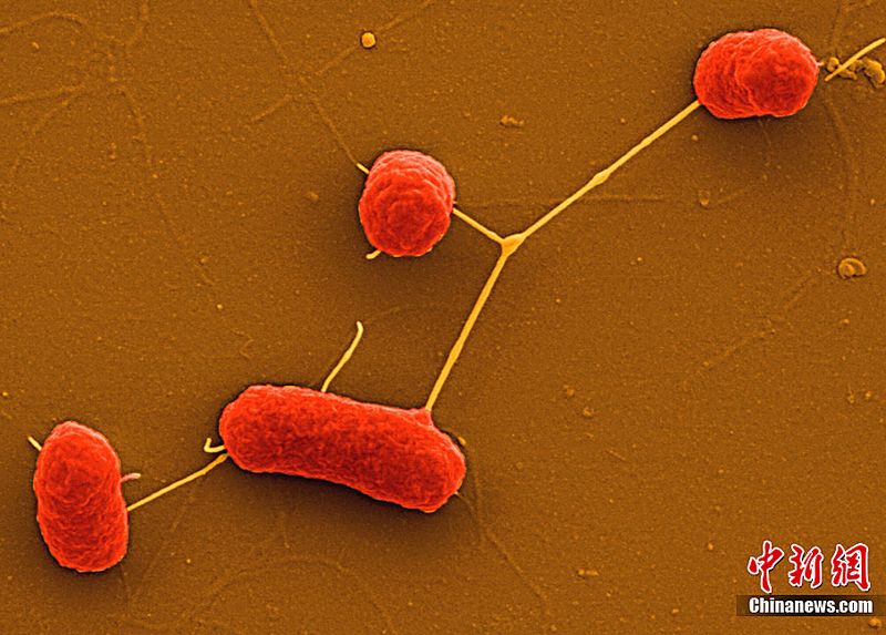 Das Helmholtz-Zentrums für Infektionsforschung (HZI) in Braunschweig hat nun einige Elektronenmikroskopaufnahmen von EHEC-Bakterien veröffentlicht. Die in Deutschland ausgebrochene EHEC-Epidemie hat bereits 14 Menschen getötet und mehr als 140 infiziert. 