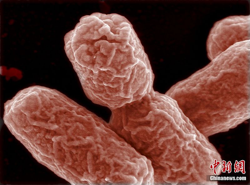 Das Helmholtz-Zentrums für Infektionsforschung (HZI) in Braunschweig hat nun einige Elektronenmikroskopaufnahmen von EHEC-Bakterien veröffentlicht. Die in Deutschland ausgebrochene EHEC-Epidemie hat bereits 14 Menschen getötet und mehr als 140 infiziert. 