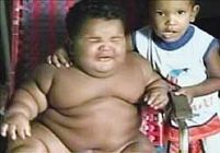 11-месячный колумбийский ребенок весом 28 кг.