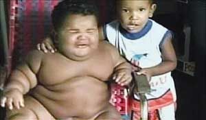 11-месячный колумбийский ребенок весом 28 кг. 