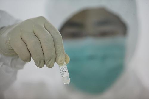 Началась массовое производство вакцины против вируса A/ H1N1 