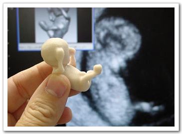 Модель 12-недельного внутриутробного младенца