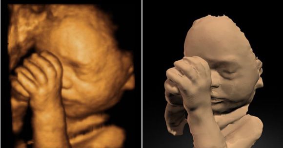 Модель 32-недельного внутриутробного младенца
