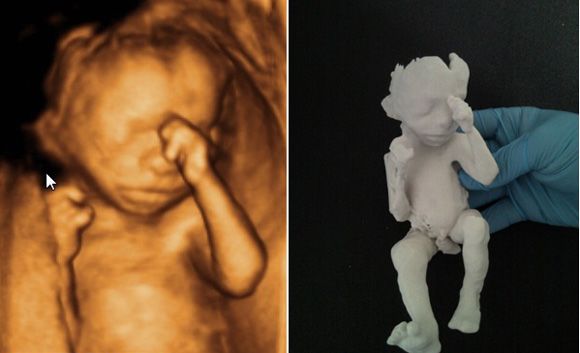Модель 18-недельного внутриутробного младенца