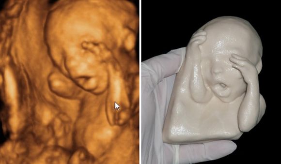 Модель 21-недельного внутриутробного младенца