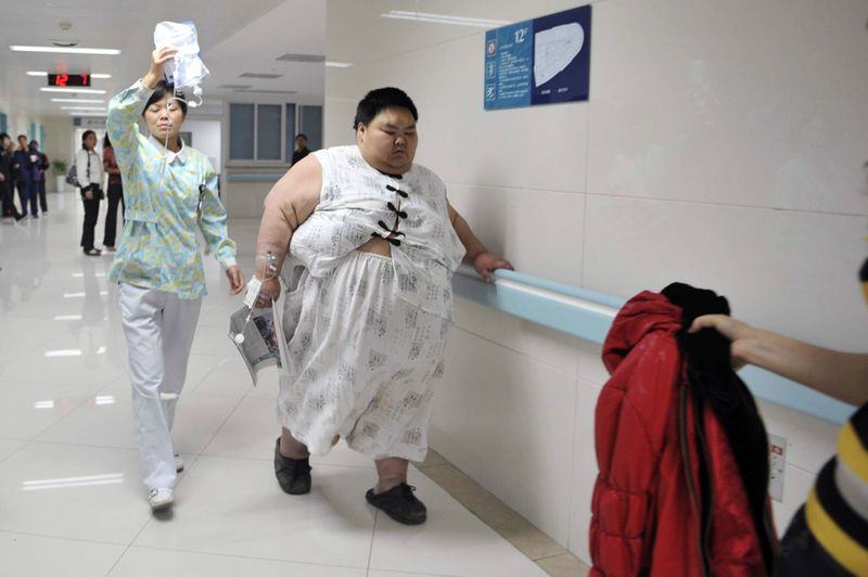 Тяжелая жизнь самого толстого человека в Китае – Лян Юна 