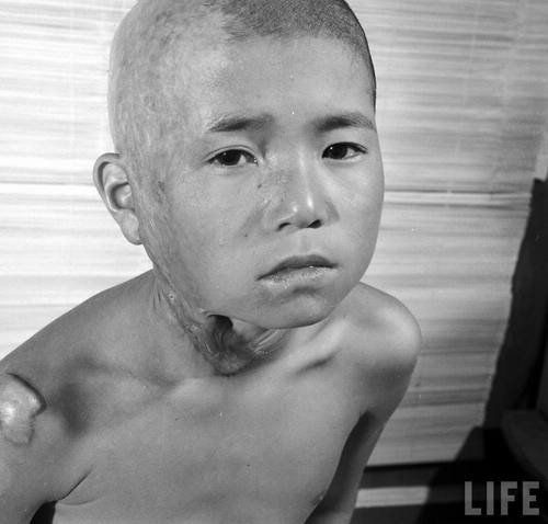 Хиросима после взрыва атомной бомбы США 
