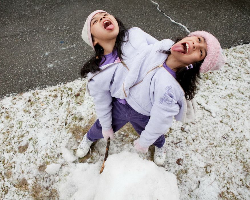 11-летние сиамские сестры-близнецы в Мексике
