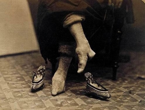 Древний китайский обычай - бинтование женских ног