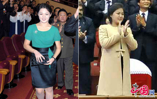 Почему резко потолстела жена лидера КНДР?!  