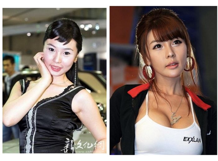 Южнокорейские модели: до и после пластики