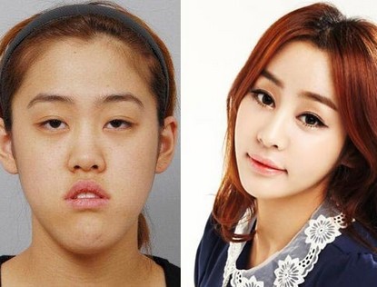 Южнокорейская телепрограмма превращает уродливых девушек в красавиц 