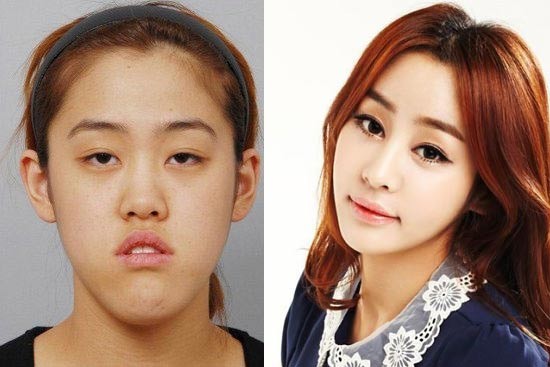 Южнокорейская телепрограмма превращает уродливых девушек в красавиц 
