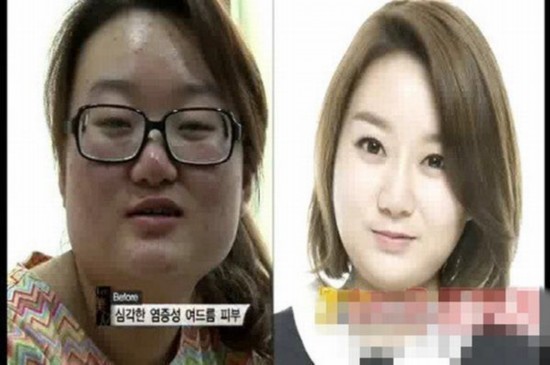 Южнокорейская телепрограмма превращает уродливых девушек в красавиц