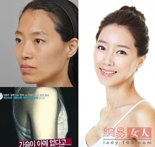 Южнокорейская телепрограмма превращает уродливых девушек в красавиц