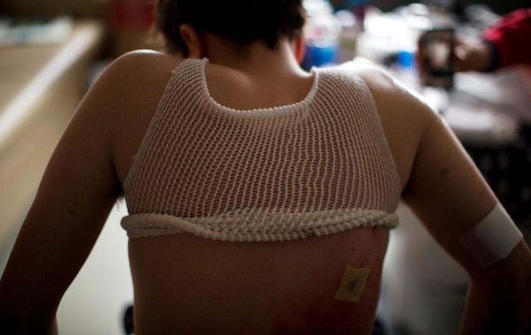 Жертва взрывов на бостонском марафоне Джефф Бауман: жизнь после взрывов