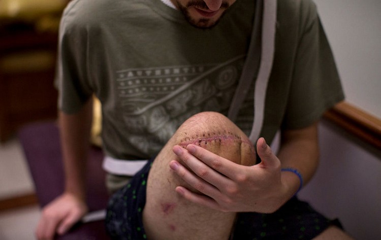 Жертва взрывов на бостонском марафоне Джефф Бауман: жизнь после взрывов