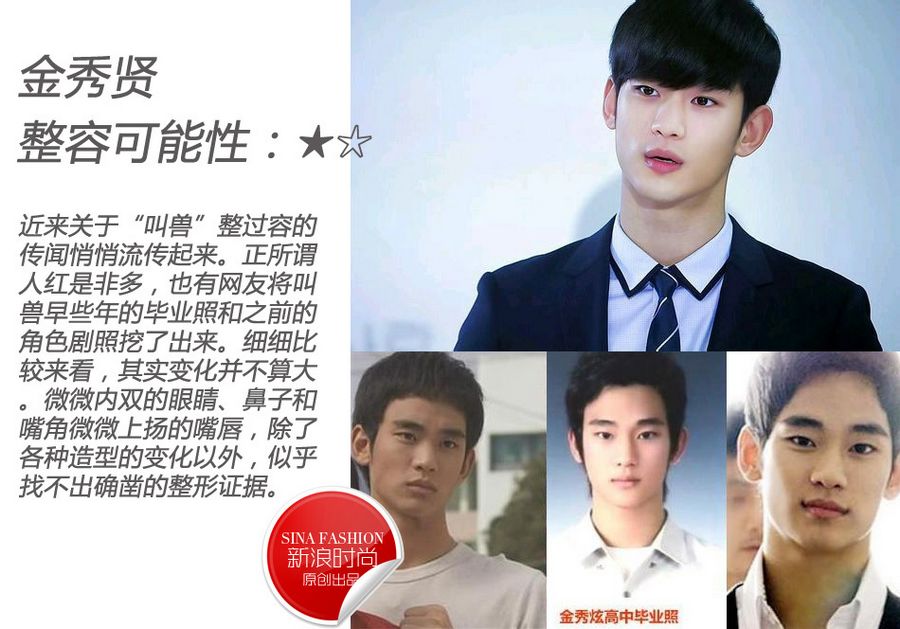 Популярные мужчины-звезды. Кто из них сделал пластики?