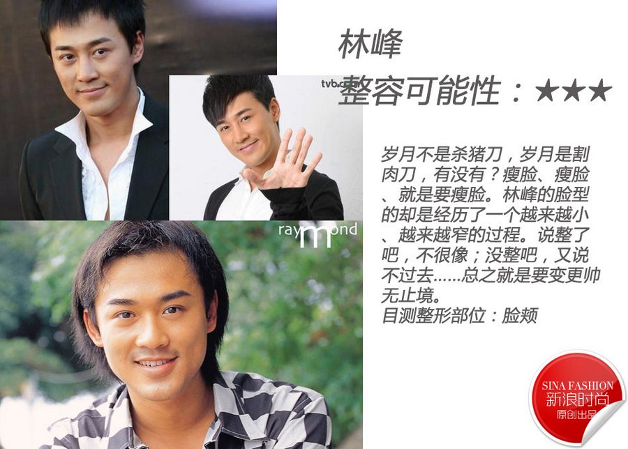 Популярные мужчины-звезды. Кто из них сделал пластики?