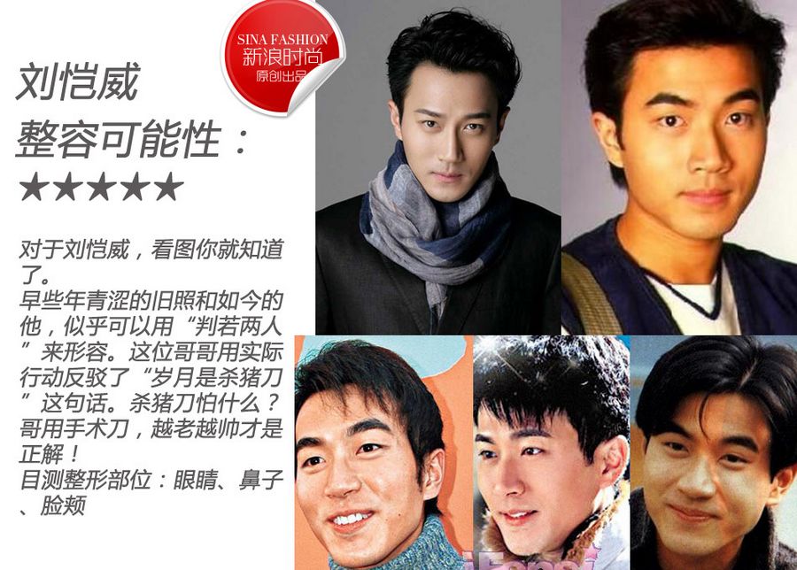 Популярные мужчины-звезды. Кто из них сделал пластики?