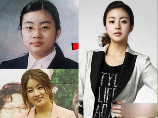 Южнокорейские звезды до и после пластики