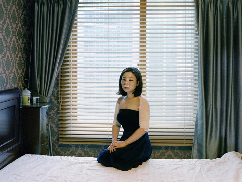 Шокирующие фото: женщины в номере для реабилитации после пластической операции – ужасающая стоимость красоты