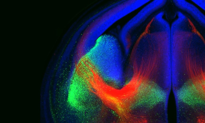 Раскрыт секрет работы головного мозга: красота в «черепной коробке»
