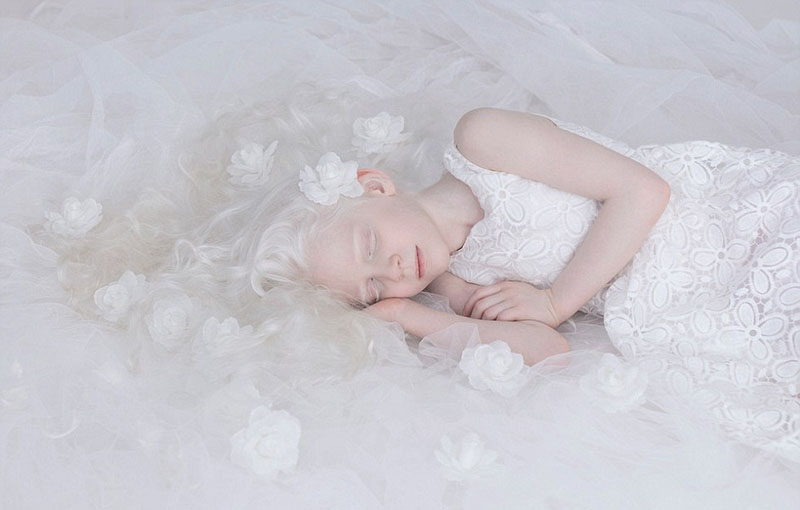 Альбиносы в объективе русского фотографа: они так милые, как ангелы