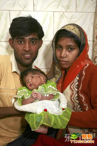Un bebé nacida con dos caras considerada como una diosa en India 3