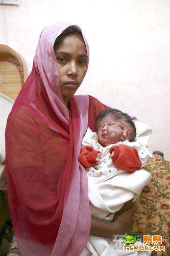 Un bebé nacida con dos caras considerada como una diosa en India 4