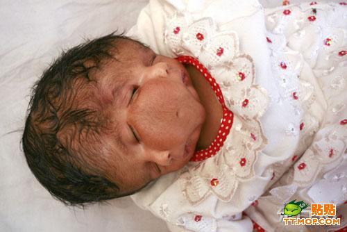 Un bebé nacida con dos caras considerada como una diosa en India 5
