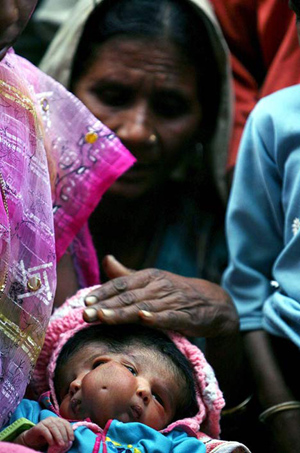 Un bebé nacida con dos caras considerada como una diosa en India 9