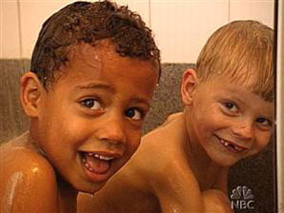 Los 10 casos de gemelos más extraordinarios del mundo 10
