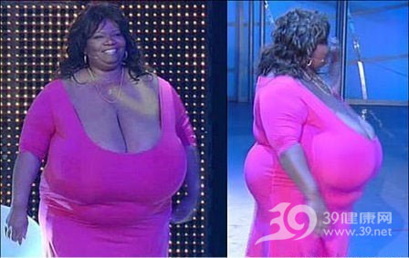 La mujer con los pechos naturales más grandes, pesando 18 kilos 1