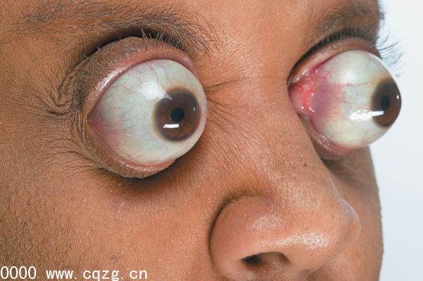 Récords mundiales del cuerpo humano 6