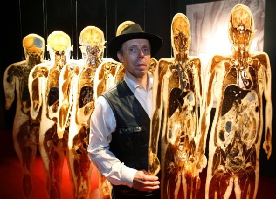 Doctor Muerte,Gunther Von Hagens, cadáveres ,cadáveres plastificados haciendo el amor