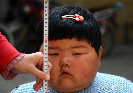 niña china edad dos años pesa 45 kilos 7