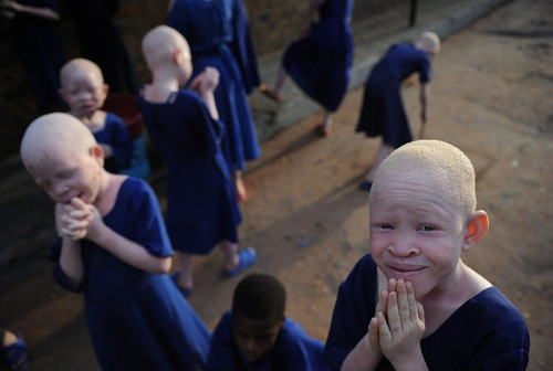 Sufren matanza los albinos africanos 1