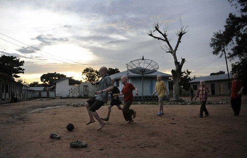 Sufren matanza los albinos africanos 5