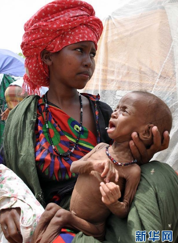 Somalia-hambre-crisis-humanitaria-Cuerno de África 4