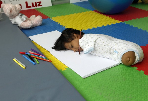 Yovana Yumbo Ruiz, niña peruana vive sin brazos ni piernas Yovana Yumbo Ruiz, niña peruana vive sin brazos ni piernas