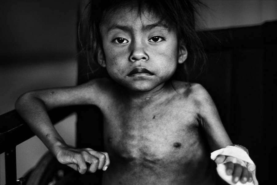 Hambre en Guatemala