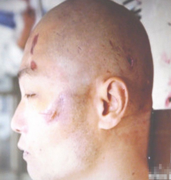 Publican las fotos de la autopsia de Zhou Kehua, el asesino a nueve personas desde 2004 en China